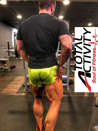 femoral Alejandro Martin